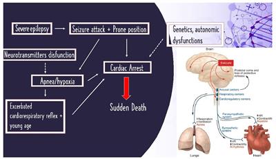 The analysis of SUDEP forensic autopsies leading to preventable events